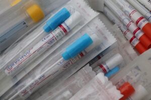 繰り返すニキビの体内ケアには腸内検査キットをどう比較すればいい？